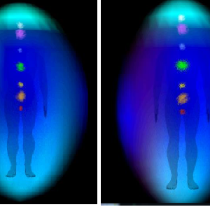 Aura ve Çakra